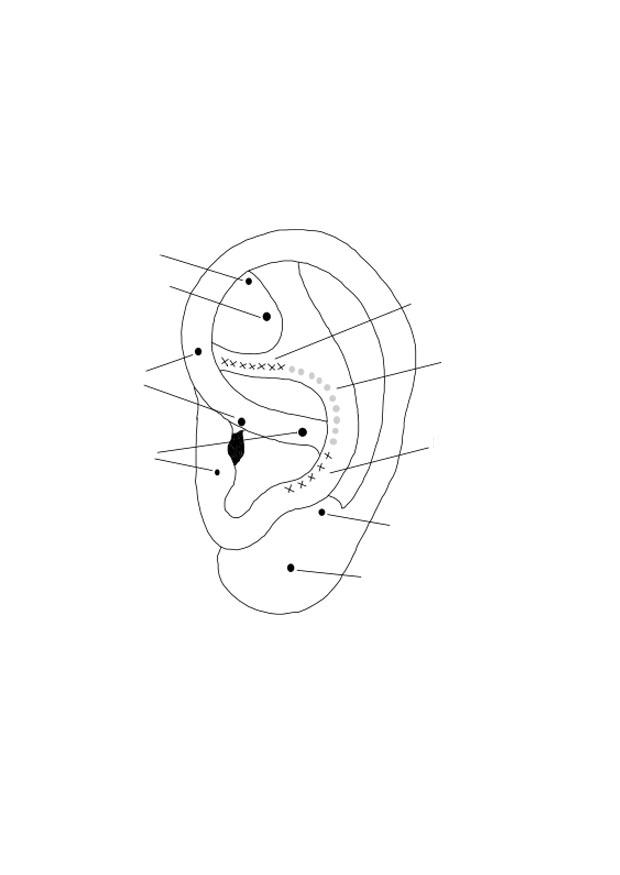 A¶ra Målarbild A¶ra