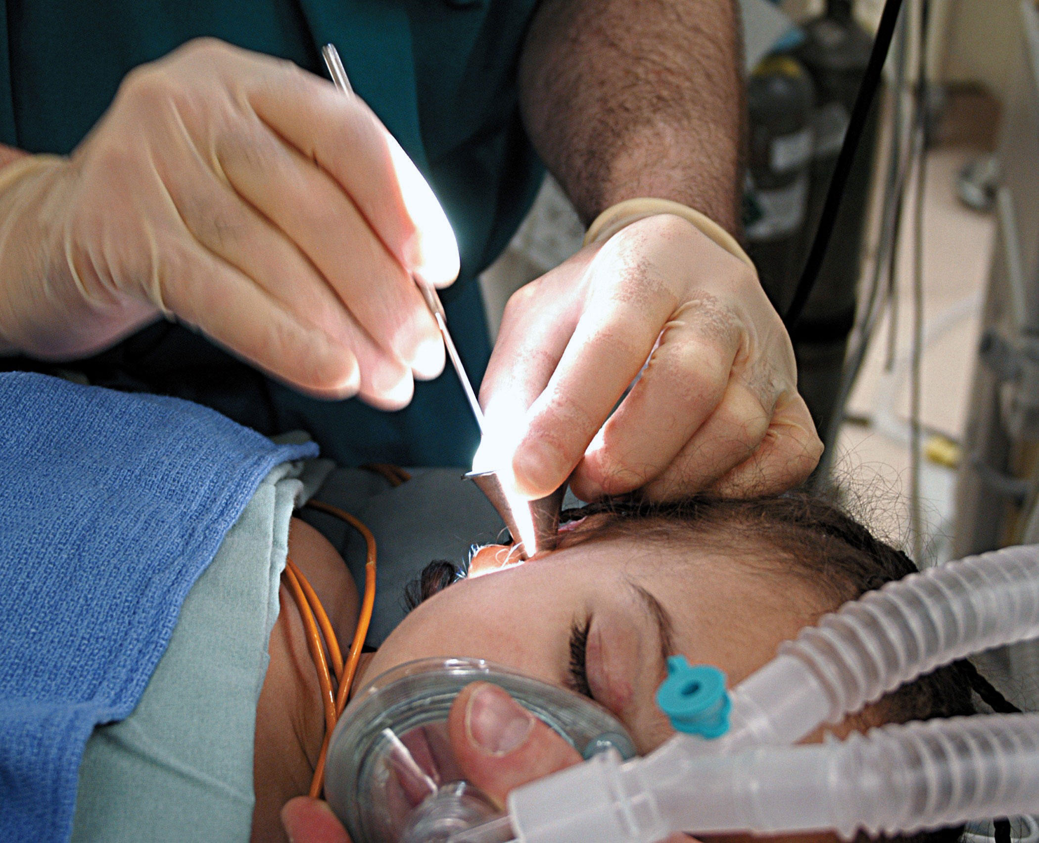 operation Foto operation