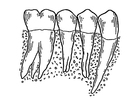 F�rgl�ggningsbilder tänder